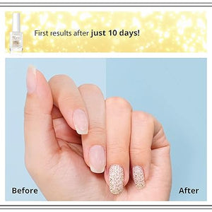 Eveline 8-in-1 Golden Shine Nail Conditioner - Strengthening Nail Treatment 12ml