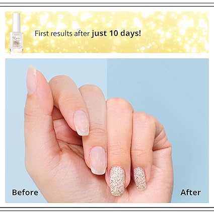 Eveline 8-in-1 Golden Shine Nail Conditioner - Strengthening Nail Treatment 12ml